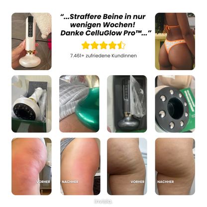 CelluGlow Pro™ Anti-Cellulite Massagegerät mit Wärme & Vakuum