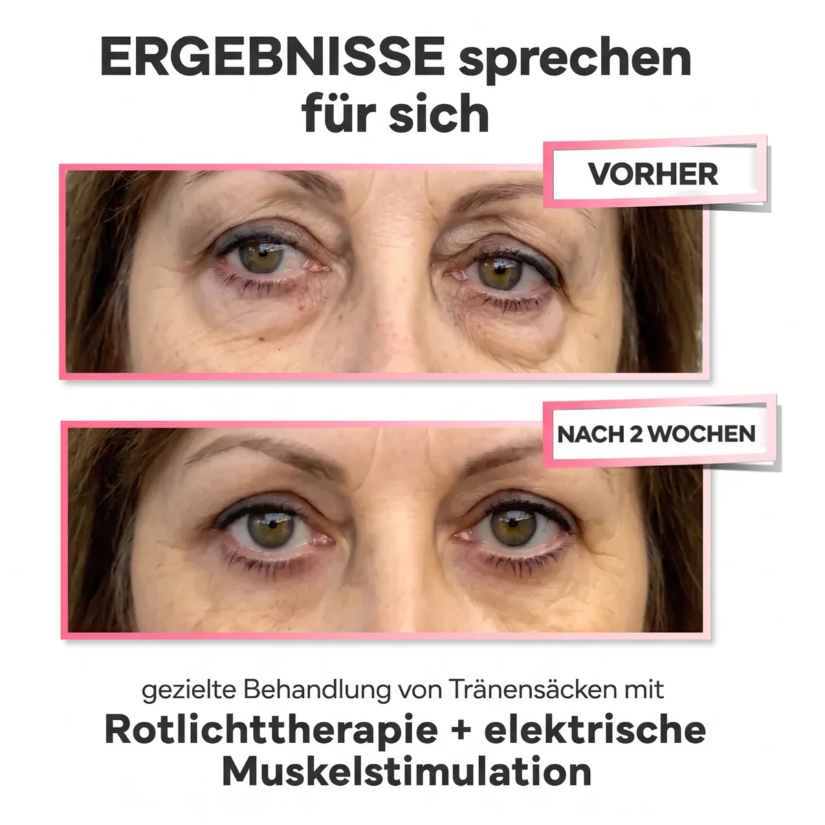 LUMIN EYE™ Rotlicht & EMS Brille