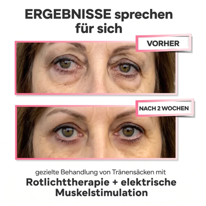 LUMIN EYE™ Rotlicht & EMS Brille