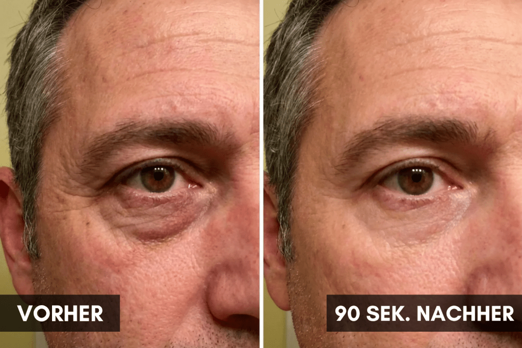 LOOK ALIVE Anti-Augenringe Roller - invisla