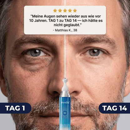 LOOK ALIVE Anti-Augenringe Roller - invisla