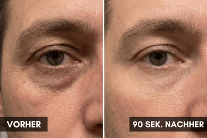 LOOK ALIVE Anti-Augenringe Roller - invisla